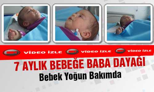 VİCDANSIZ BABA KENDİ ÇOCUÐUNA ACIMADI